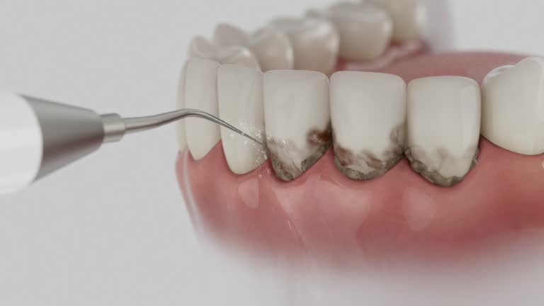 Reliable Dental Implants contractor in Tara Hills, CA by Smile Center Dentistry
